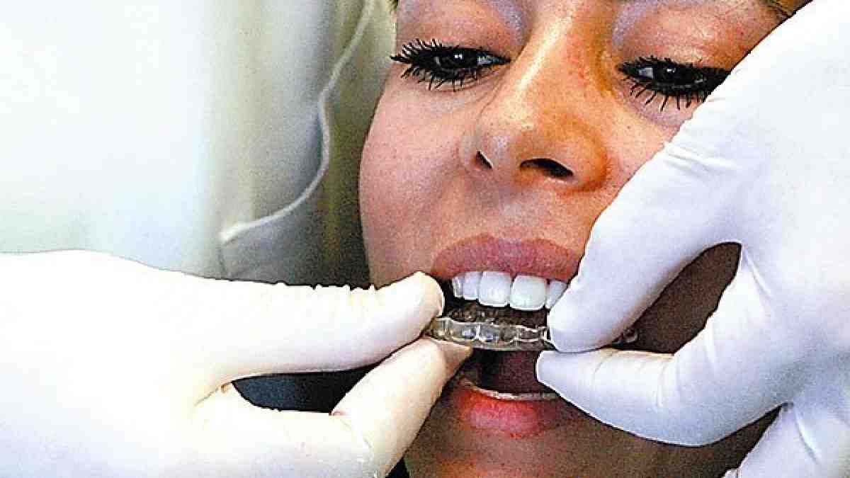 Are dental night guards worth it?