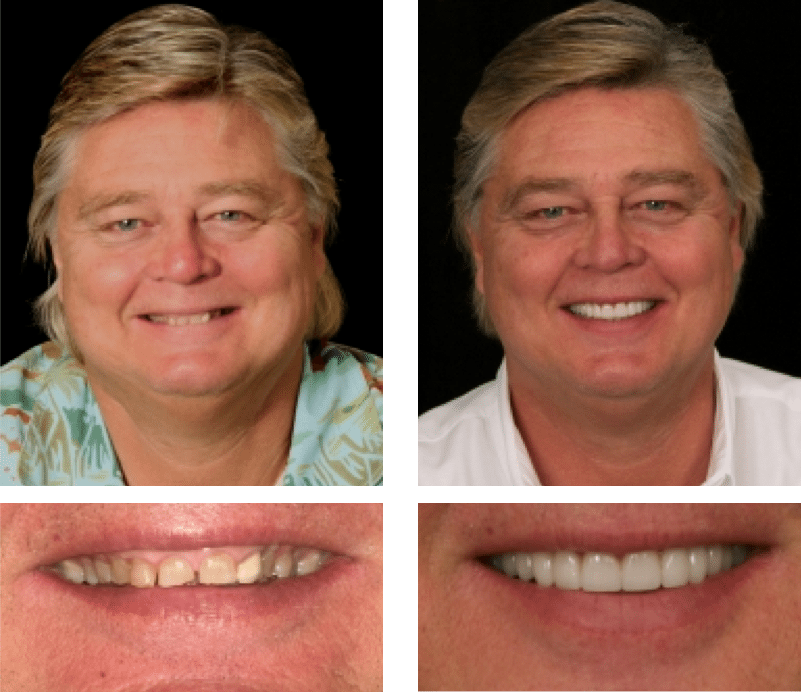 Best cosmetic dentist houston