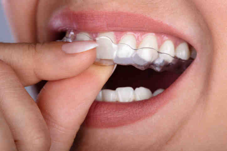 Can a dentist prescribe Invisalign?