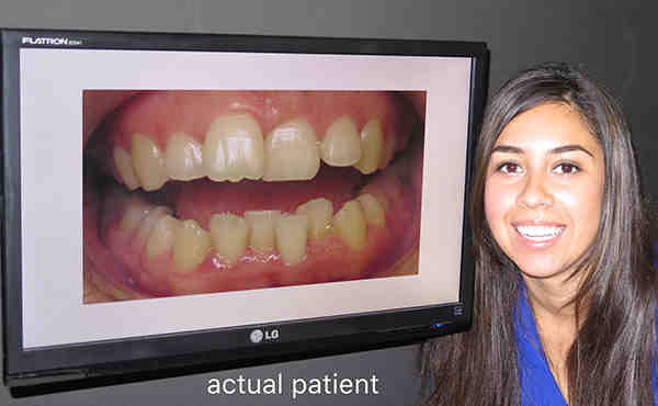 Can a dentist prescribe Invisalign?