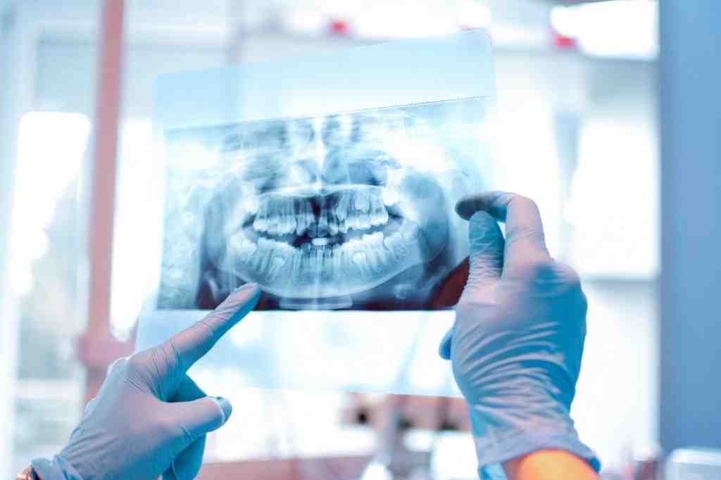 Do I have Denti-Cal if I have Medi-Cal?