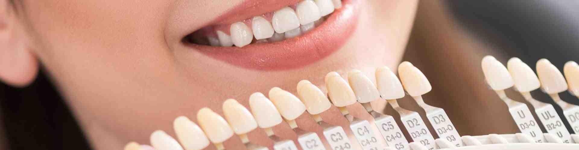 How Much Does a full dental makeover cost?
