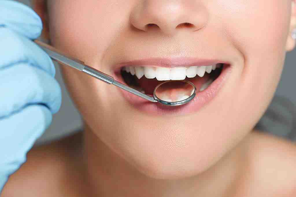How Much Does a full dental makeover cost?