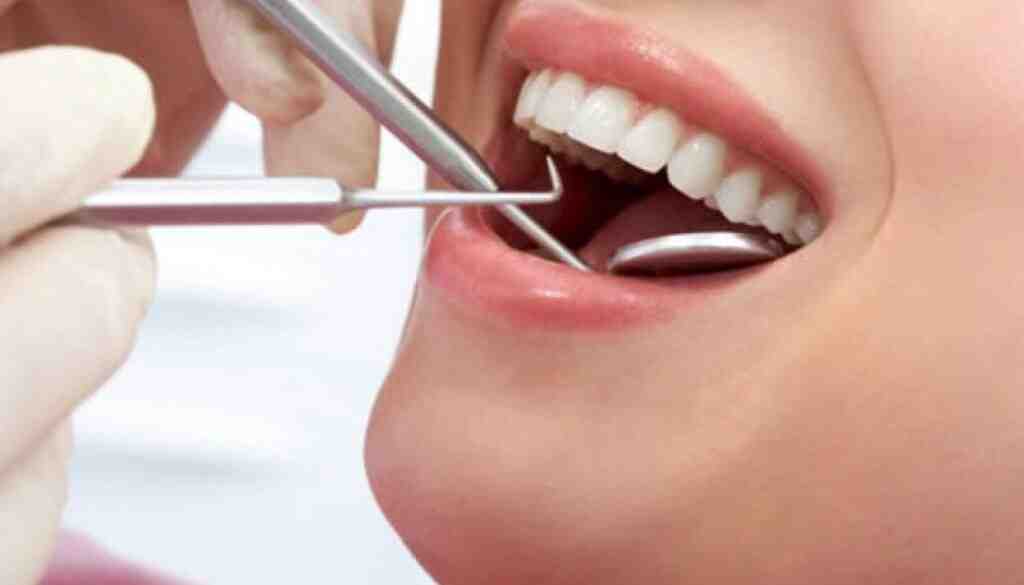 How Much Does a full dental makeover cost?