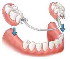 How can I get free cosmetic dentistry?