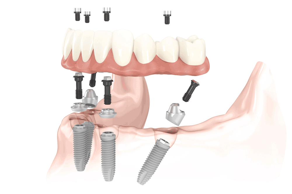 How do I find the best dentist in my area?