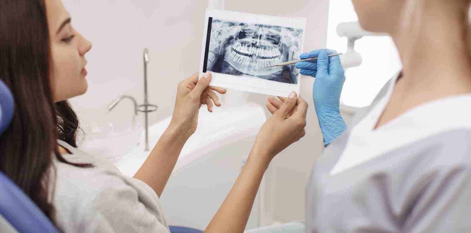 How much are dental implants in San Diego?