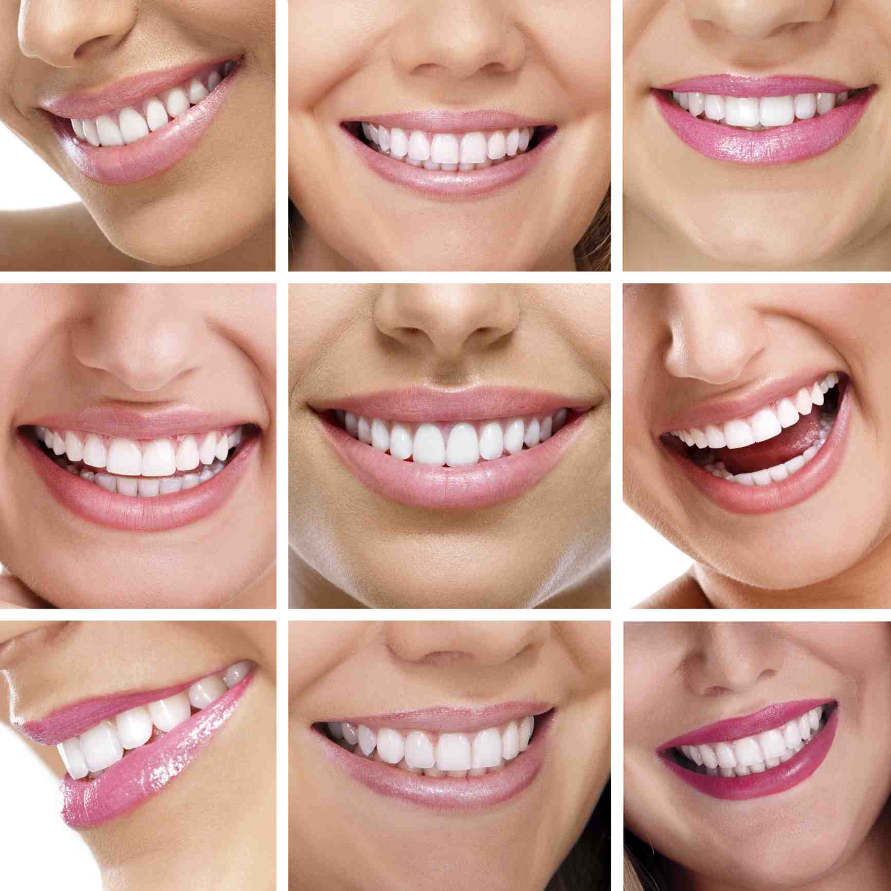 How much do cosmetic dental veneers cost?