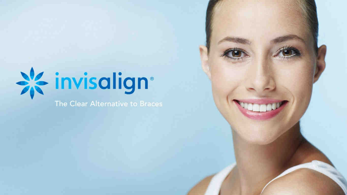 How much does Invisalign cost in San Diego?