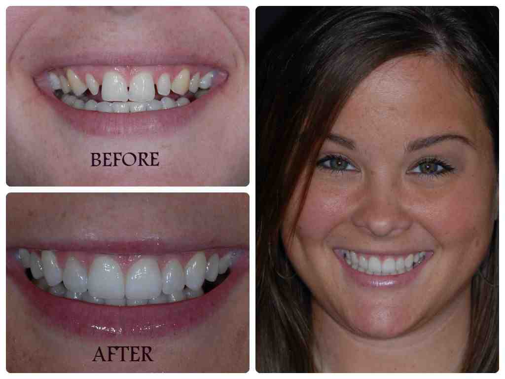 How much does cosmetic dental work cost?