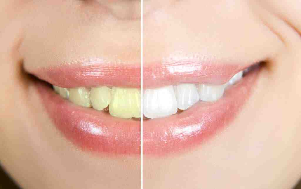 How much does cosmetic dental work cost?