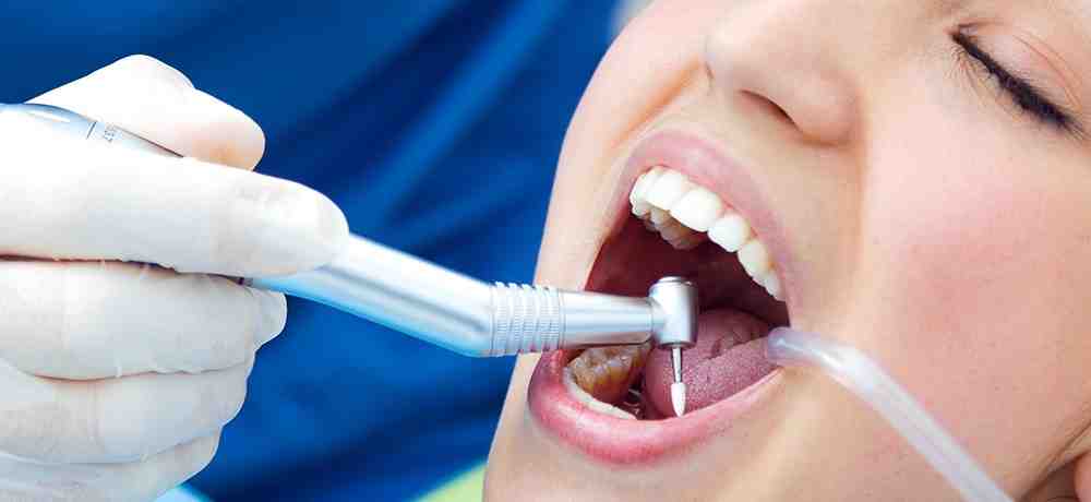 How much does it cost to replace mercury fillings?