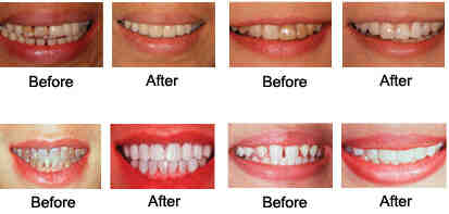 What are cosmetic dental procedures?