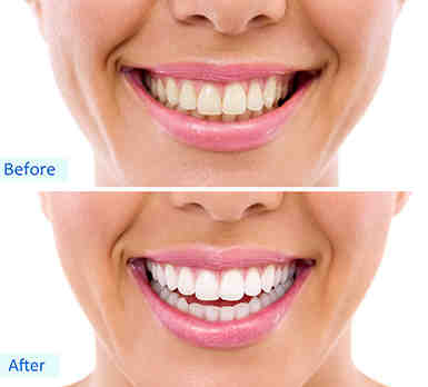 What is the difference between cosmetic dentistry and general dentistry?