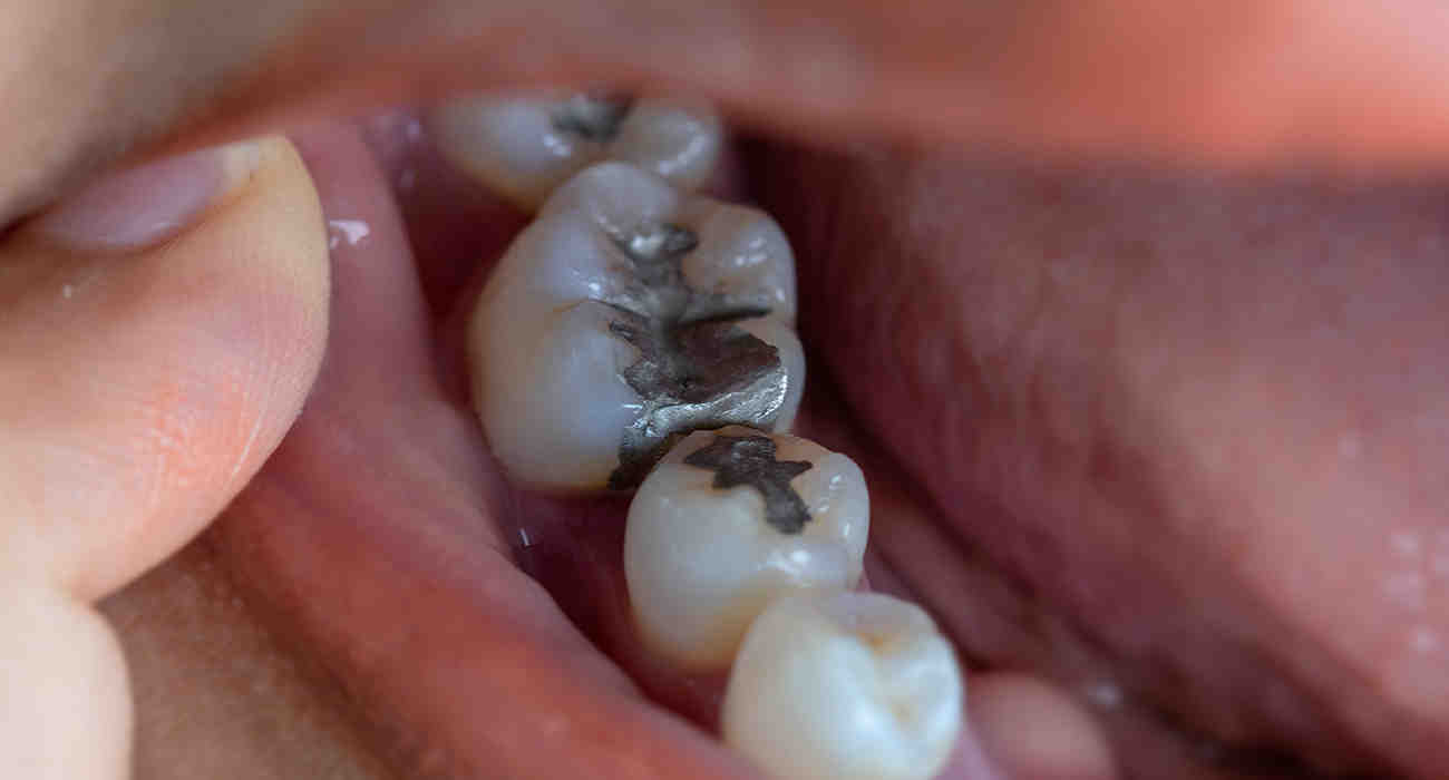 What to do if you have a dental emergency at night?
