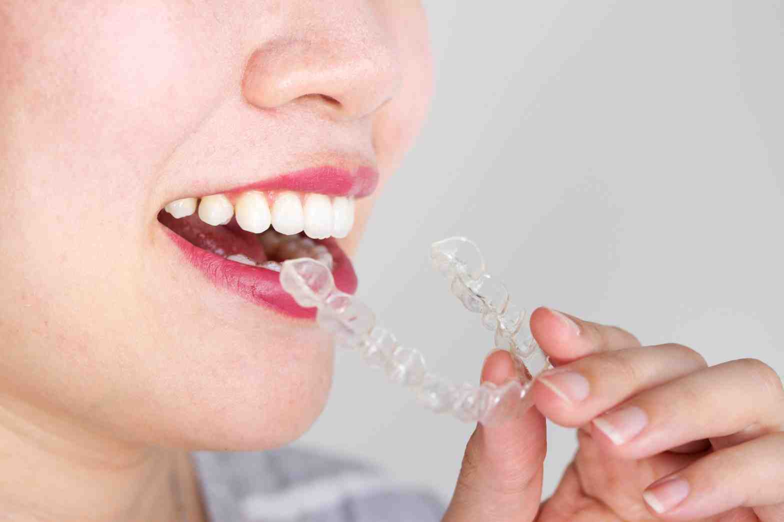 Can a dentist prescribe Invisalign?