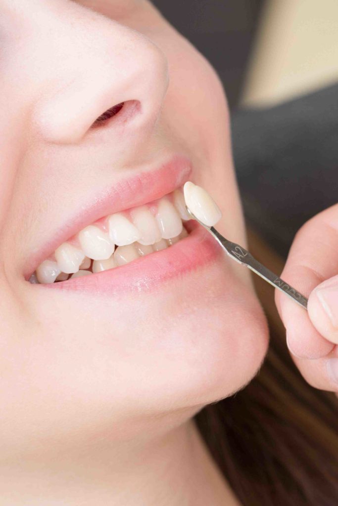 Canine dentist san diego