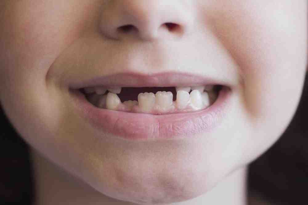 How do I choose a pediatric dentist?