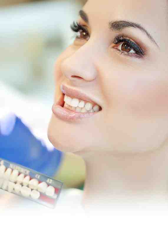 How much are veneers in San Diego?