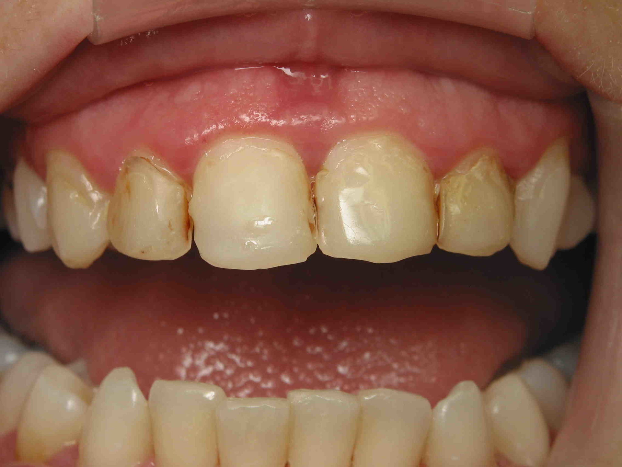 Cosmetic Dentist San Diego Salary
