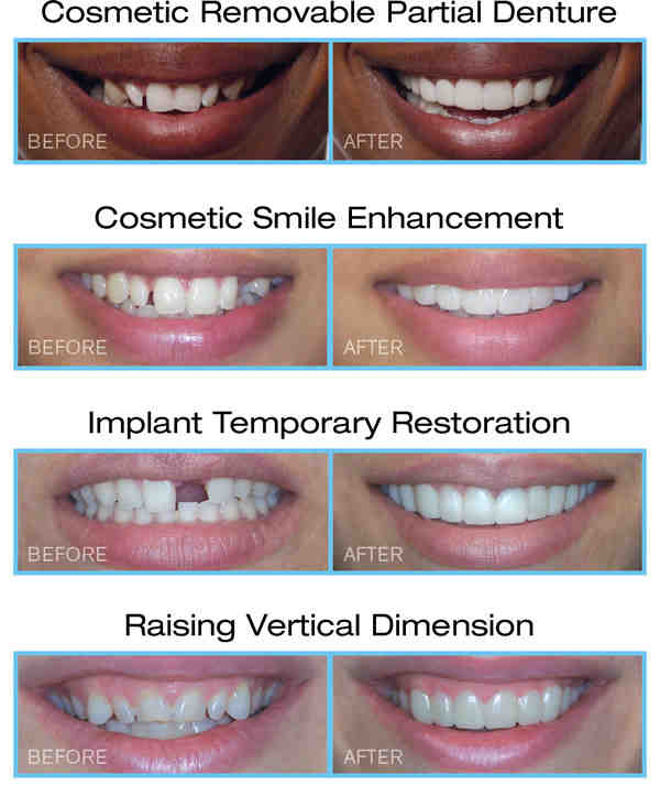 How much does a filling cost in san diego dentist
