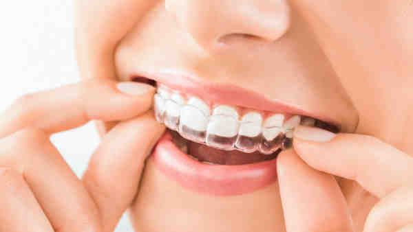 Invisalign dentist in san diego