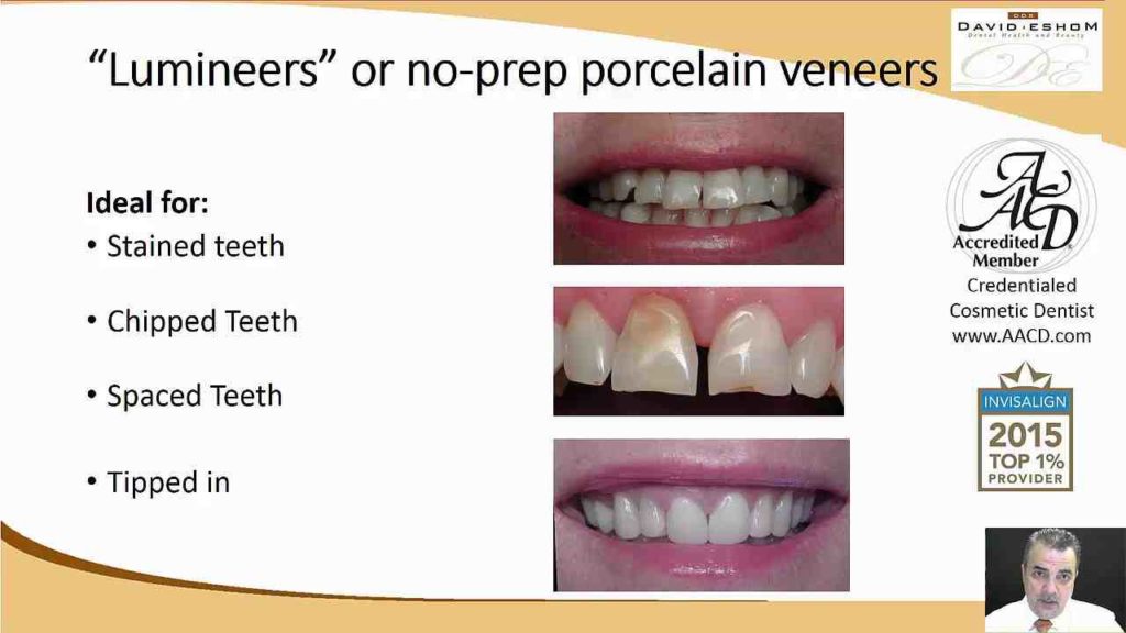 Is aacd lab or dentist accredited perfect smile san diego