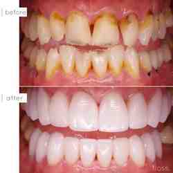What type of dentist does cosmetic dentistry?