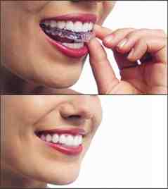 Can a dentist prescribe Invisalign?