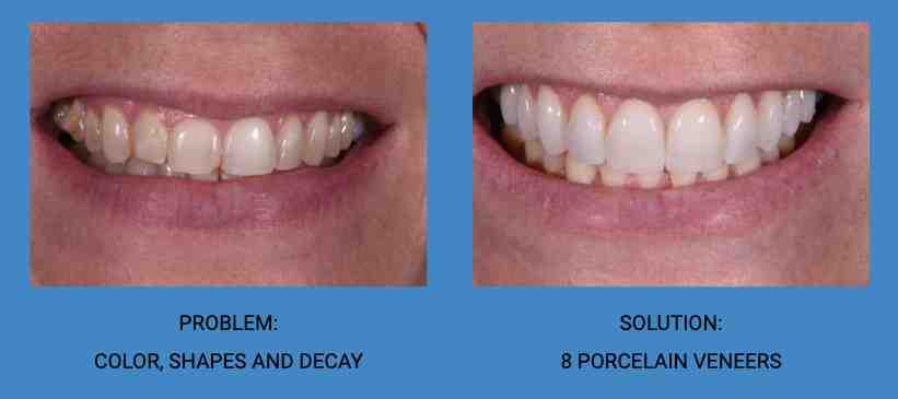 Can a general dentist do cosmetic dentistry?