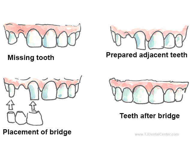 Do Mexican dentists take American insurance?