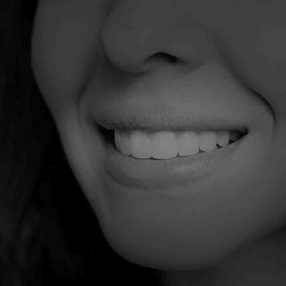 How much do veneers cost in Tijuana?