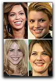 How much is a set of veneer teeth?