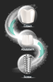 How much should a crown cost without insurance?