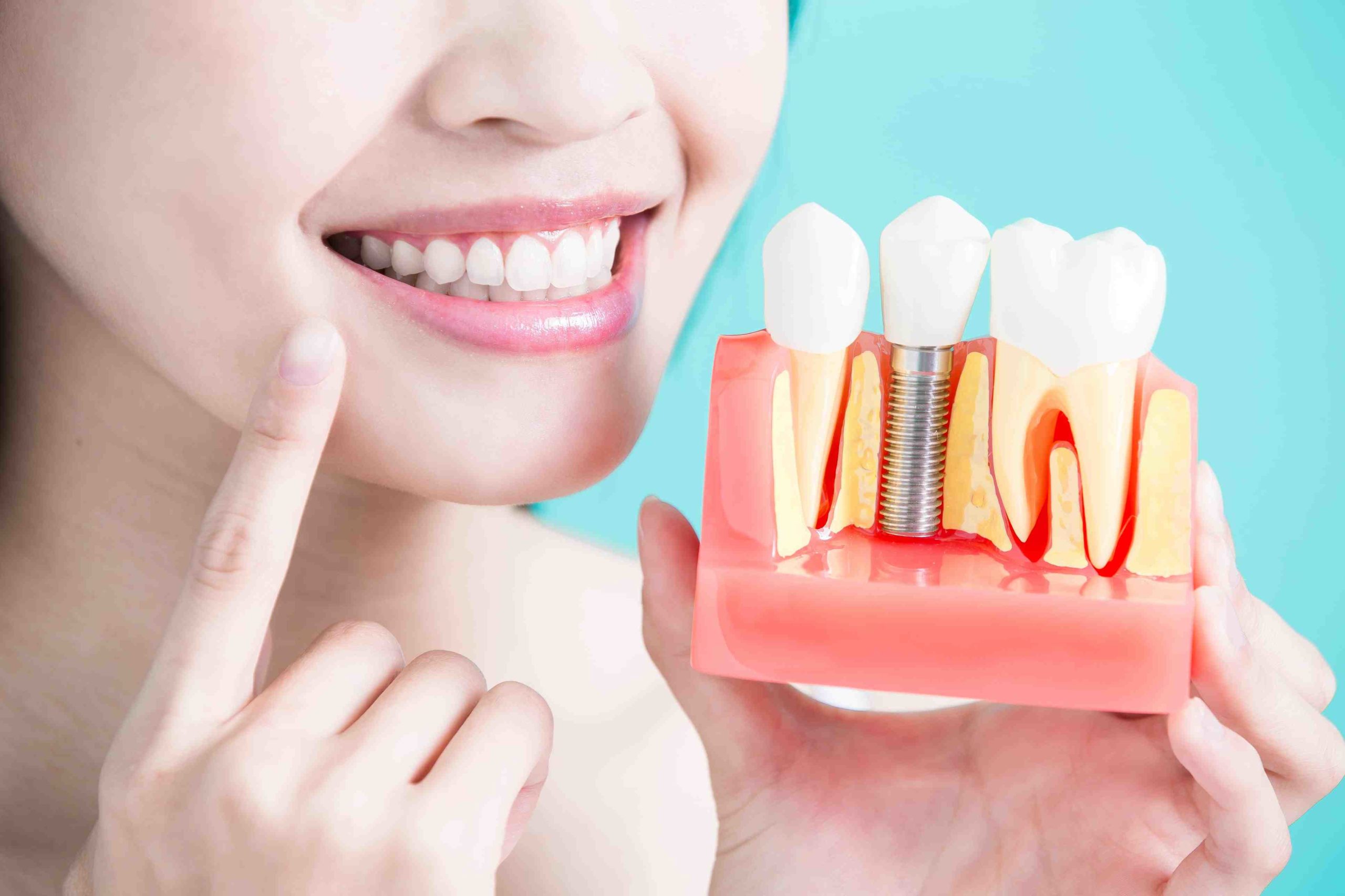 What is the cheapest price for dental implants?
