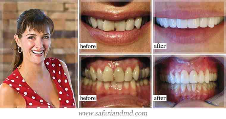 Where is the best place to get dental work done?