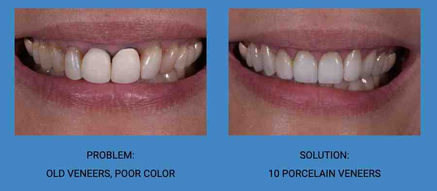 How do you find a good cosmetic dentist?